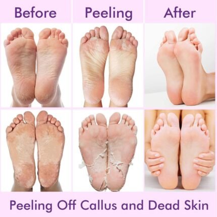 Foot Peeling Mask Dead Skin Remover Socks Lavender