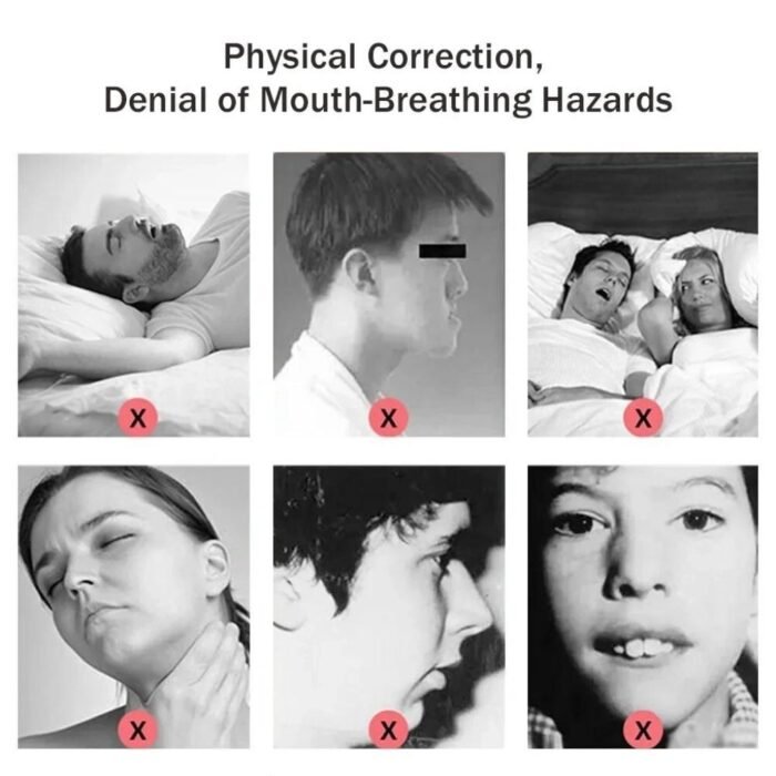 Anti Snoring Mouth Tape Strips