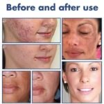 Blackthorn Skin Cleanser(Pack Of 2) - AmazingBaba