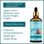 Park Daniel Premium Stretch Marks Removal Oil - AmazingBaba